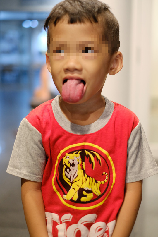 Cận cảnh ông tiên phương Tây chỉnh hình cho trẻ bất hạnh trên đất Việt - Ảnh 2.