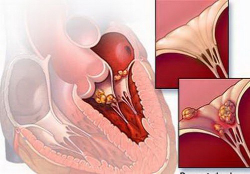 Bác sĩ nói gì trước thông tin virus lạ gây chết người hàng loạt trên mạng xã hội?