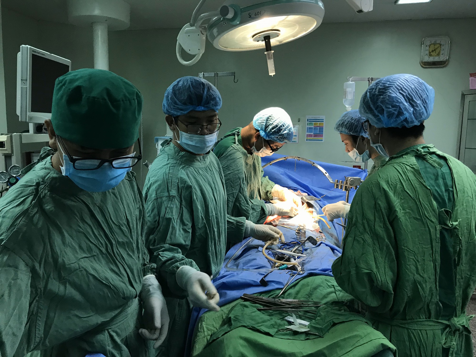 Hi hữu lấy nhiều vi&ecirc;n sỏi dạng san h&ocirc; trong ống tụy bệnh nh&acirc;n ung thư - Ảnh 1.