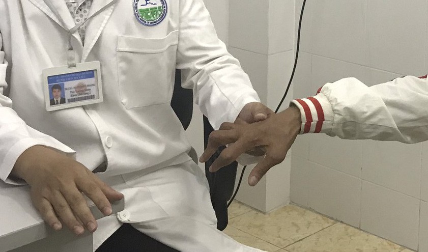 Uống "thuốc  lạ" người đàn ông bị rút gân 1 cách đáng sợ