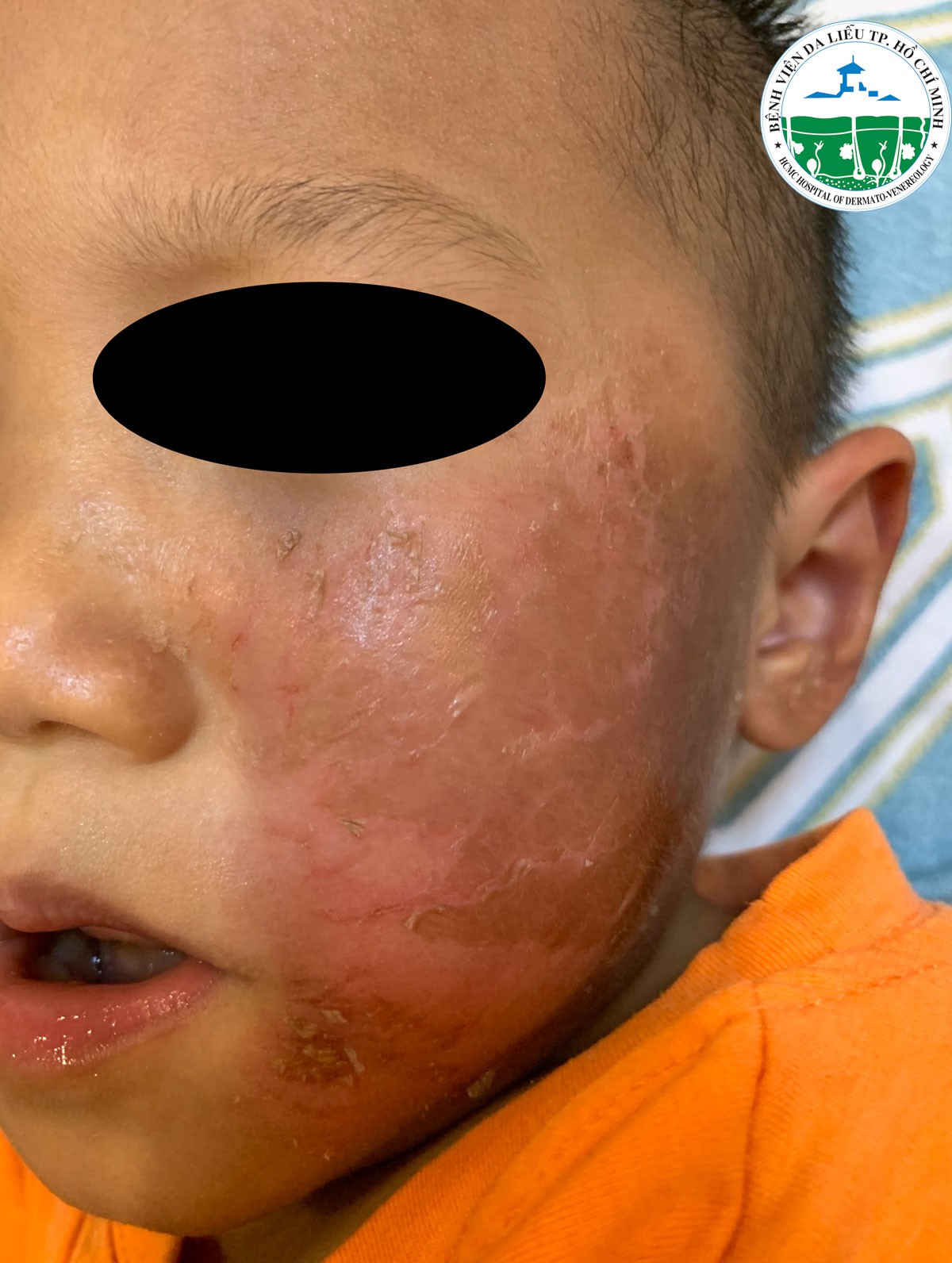 Nhiễm độc vì hóa trang Halloween