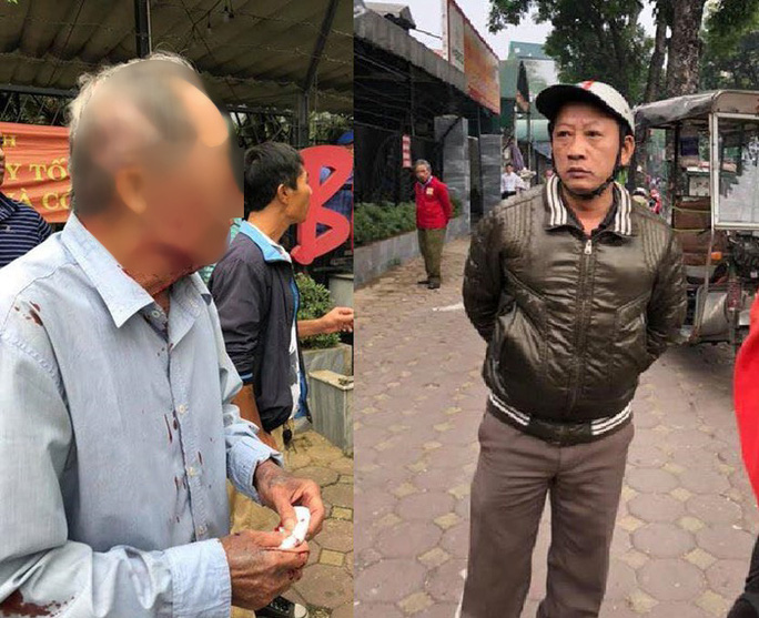 Thông tin bất ngờ về đối tượng hành hung cụ ông 79 tuổi chạy xe ôm