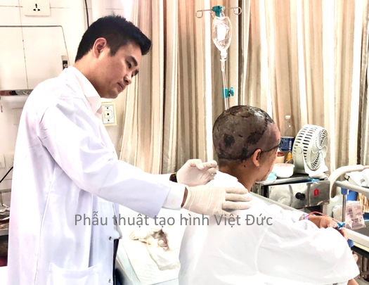 Người phụ nữ bị máy làm ren sắt lột phăng da đầu và da vùng mặt