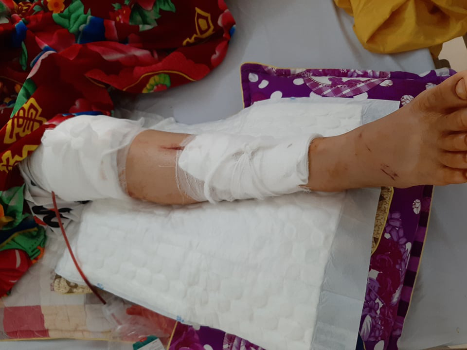 C&aacute;n bộ TP Thanh H&oacute;a điều khiển &ocirc;t&ocirc; g&acirc;y tai nạn cho nữ sinh lớp 9 rồi bỏ trốn - Ảnh 2.