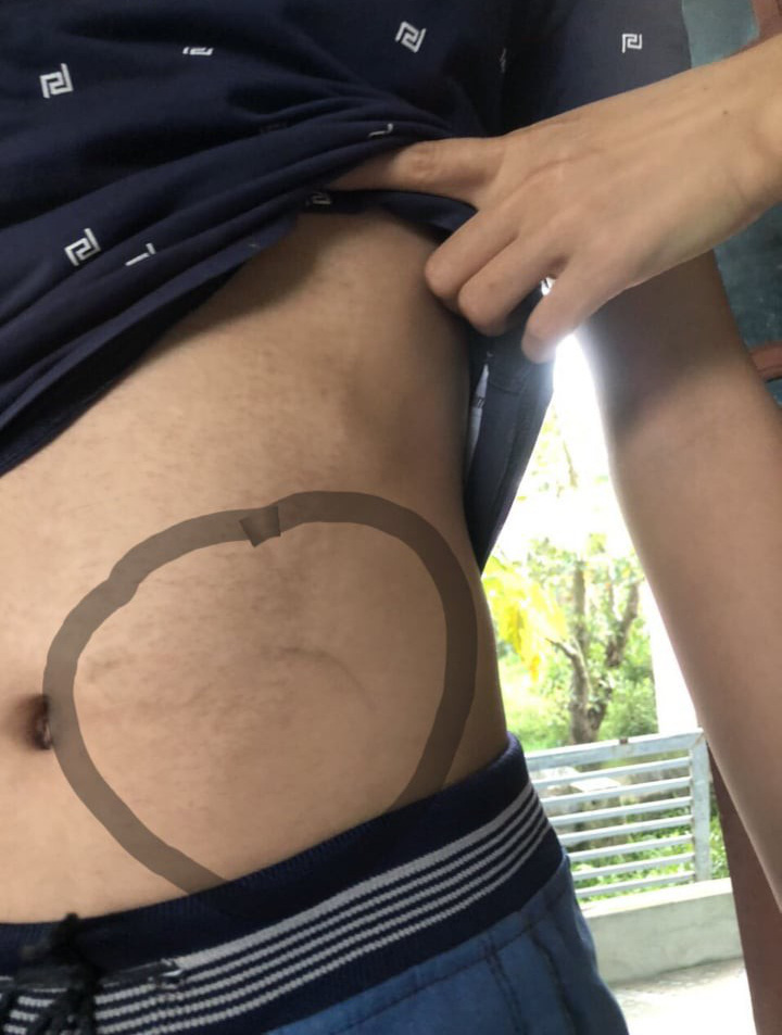 Nữ sinh bị giấu dép, 5 người lớn đi xế hộp tới xông vào trường đánh nam sinh lớp 8 - Ảnh 1.