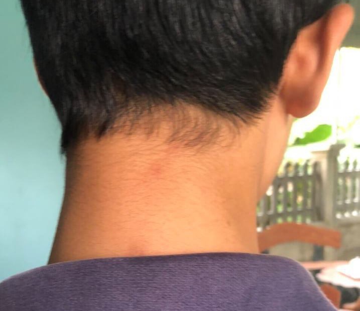 Con gái mâu thuẫn ở trường, bố kéo thêm 4 người đi ôtô tới đánh tới tấp nam sinh lớp 8