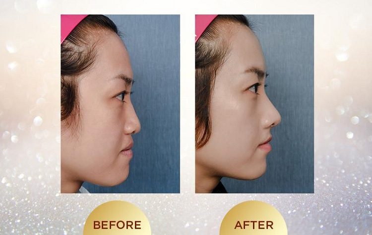 Gần đến Tết, làm gì để nhan sắc tỏa sáng? - Ảnh 2.