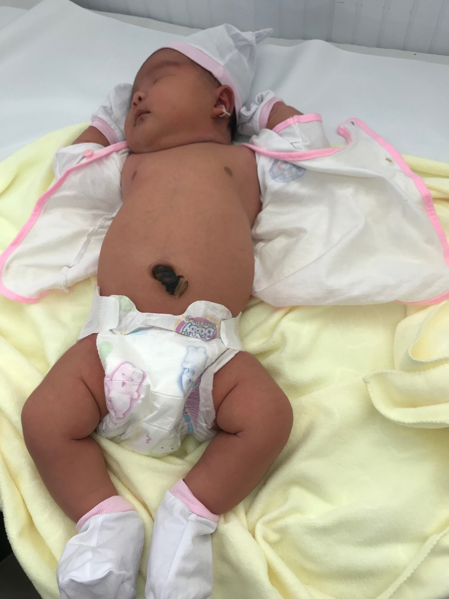 Bác sĩ ngỡ ngàng trước bé gái "khổng lồ" chào đời