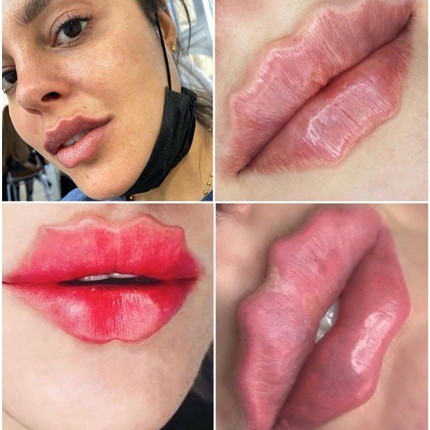 Bờ m&ocirc;i lượn s&oacute;ng kỳ qu&aacute;i đang g&acirc;y sốt - Ảnh 2.