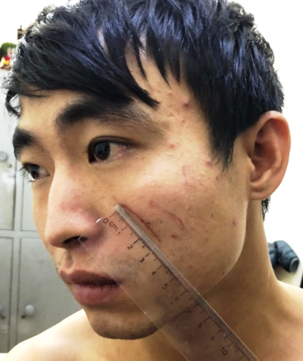 Sát hại nữ sinh viên 18 tuổi trong cơn phê ma túy đá ở nhà nghỉ