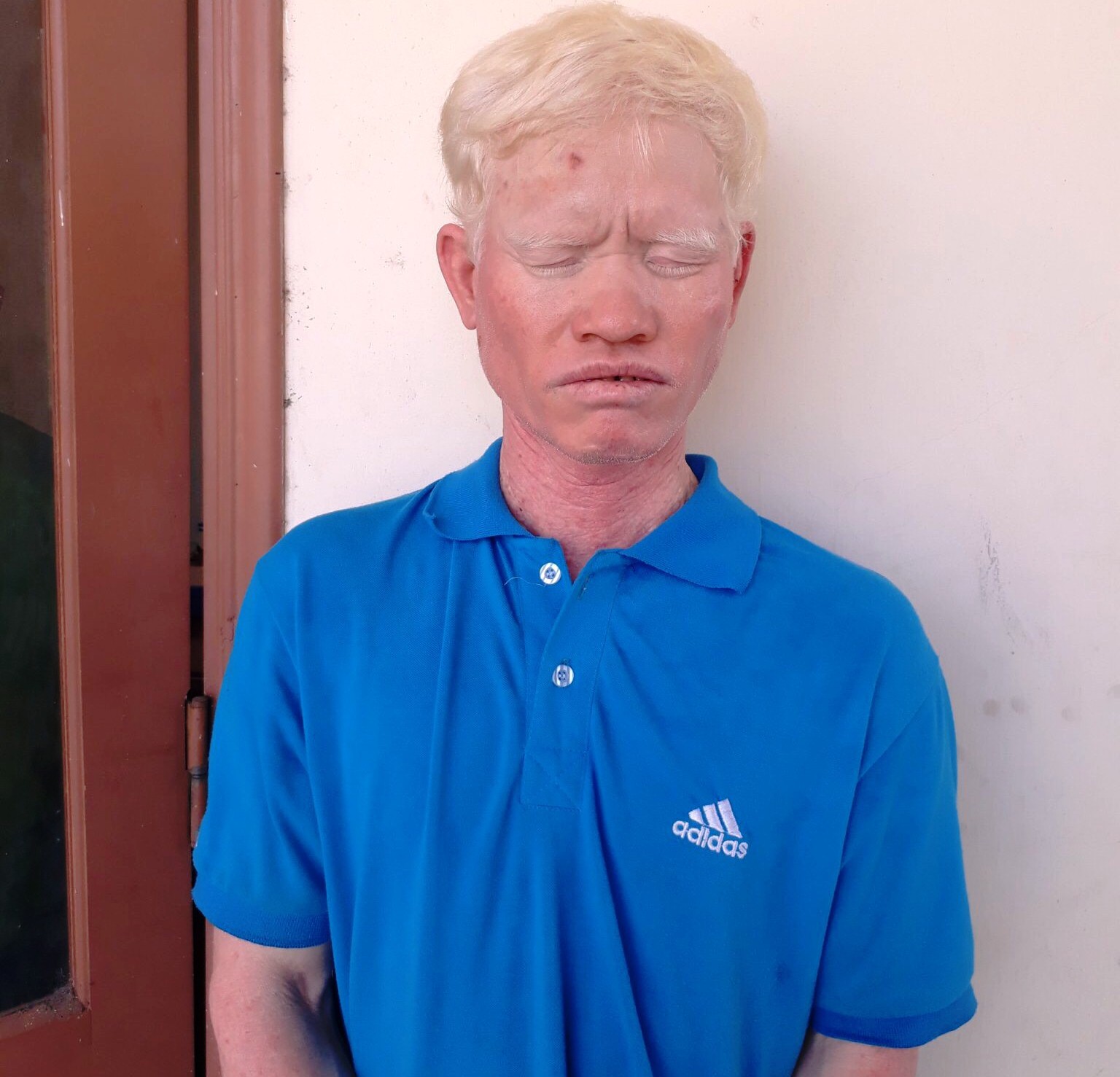 Bị đ&ograve;i tiền, người anh đ&aacute;nh em trai vỡ sọ - Ảnh 1.