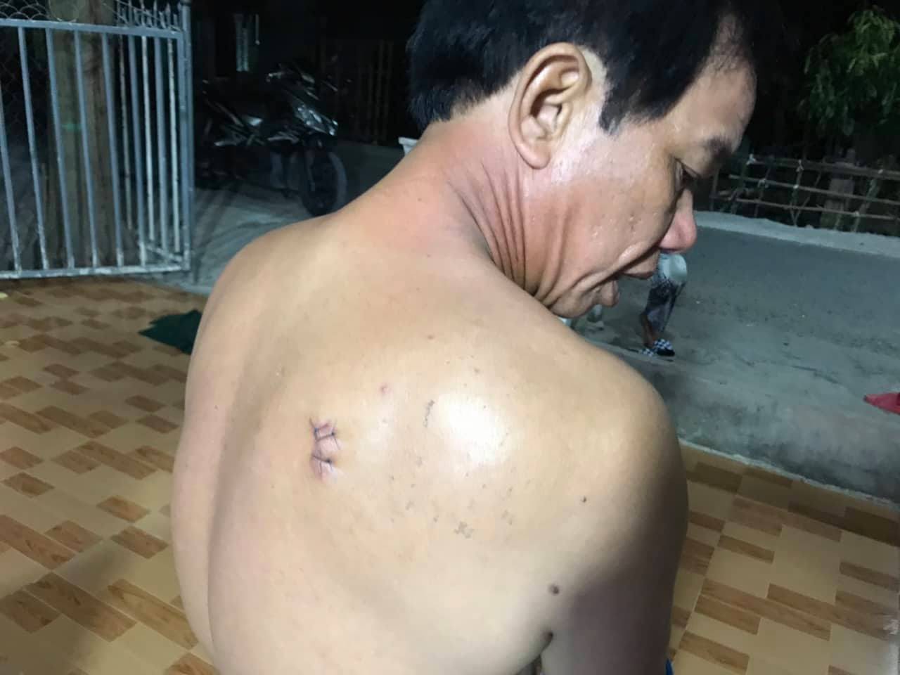 Can thiệp vợ chồng hờ h&agrave;ng x&oacute;m cự c&atilde;i, 4 người thương vong - Ảnh 2.