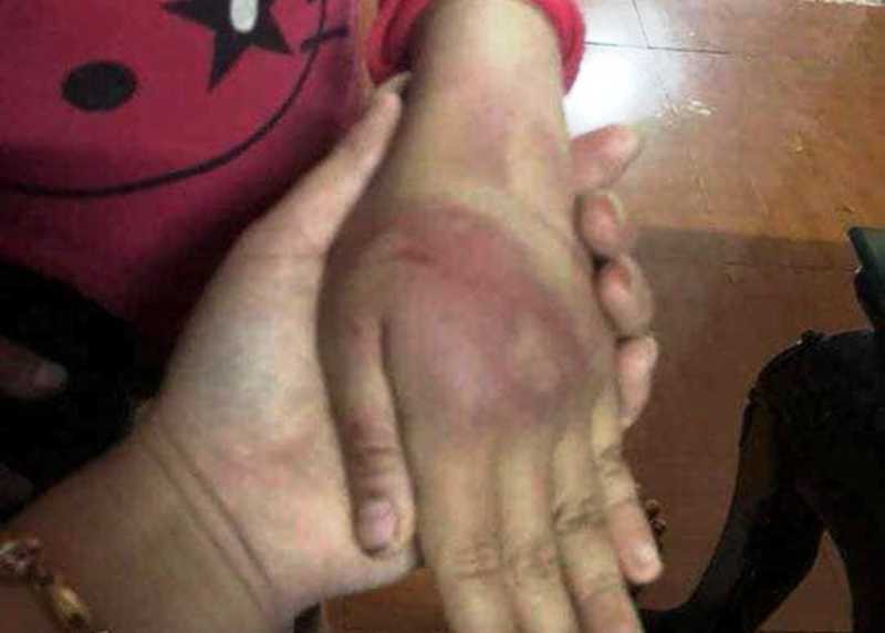 B&eacute; g&aacute;i 8 tuổi bị bố đẻ bạo h&agrave;nh th&acirc;m t&iacute;m người - Ảnh 2.