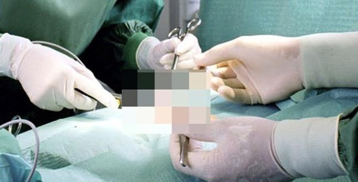 Qu&yacute; &ocirc;ng U60 bị bạn t&igrave;nh ghen ngược, cắt phăng &ldquo;của qu&yacute;&rdquo; - Ảnh 1.