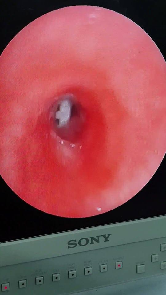 TP HCM: Ca bệnh phải đặc cách người thân vào phòng mổ