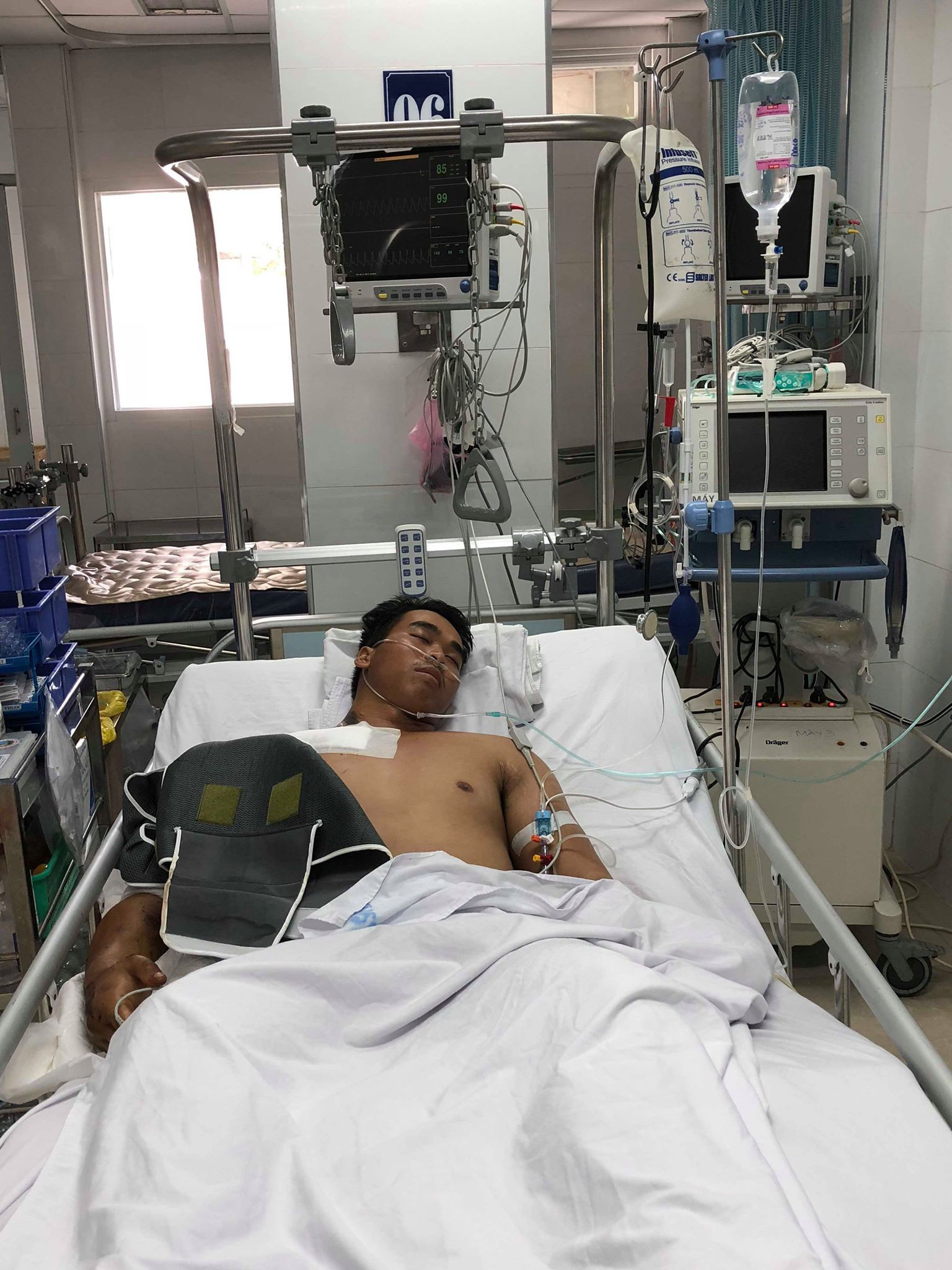 Căng thẳng cứu cánh tay của nam thanh niên bị máy trộn bê-tông cuốn
