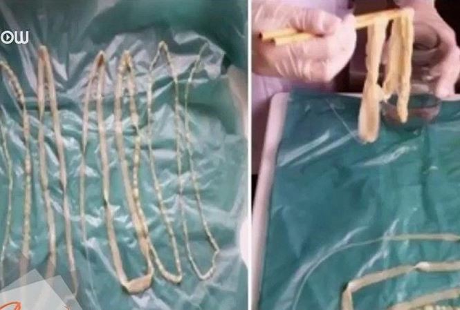 Nguyên tắc sống còn trong ăn uống để không mắc sán lợn