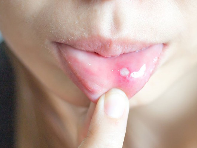 Khi nào nổi đẹn là nghiêm trọng? - Ảnh 1.