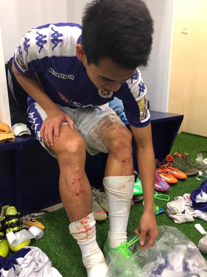 HLV Hà Nội FC đòi phạt thẻ đỏ Quế Ngọc Hải - Ảnh 1.