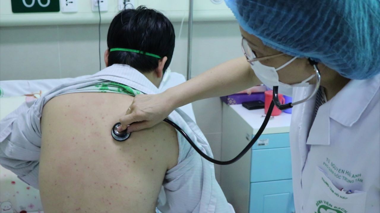 Hiếm gặp chục năm qua, người đàn ông 43 tuổi mắc bệnh ho gà