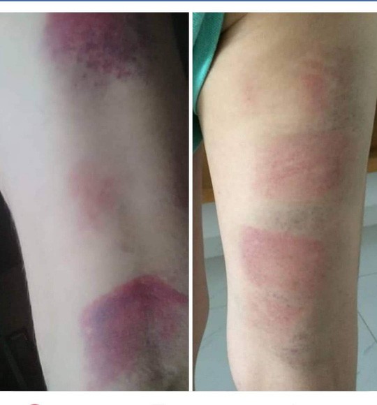 Bộ GD-ĐT v&agrave;o cuộc vụ gi&aacute;o vi&ecirc;n đ&aacute;nh t&iacute;m ch&acirc;n 22 học sinh ở Vũng T&agrave;u - Ảnh 2.