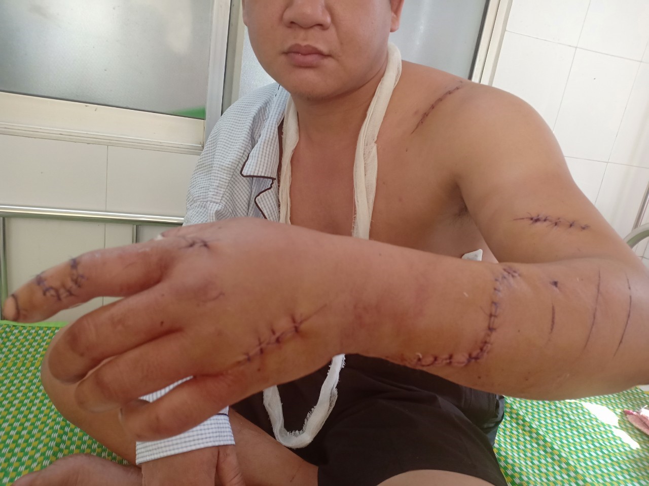 Bị chém trọng thương vì tranh cãi trong lúc đánh bài - Ảnh 1.