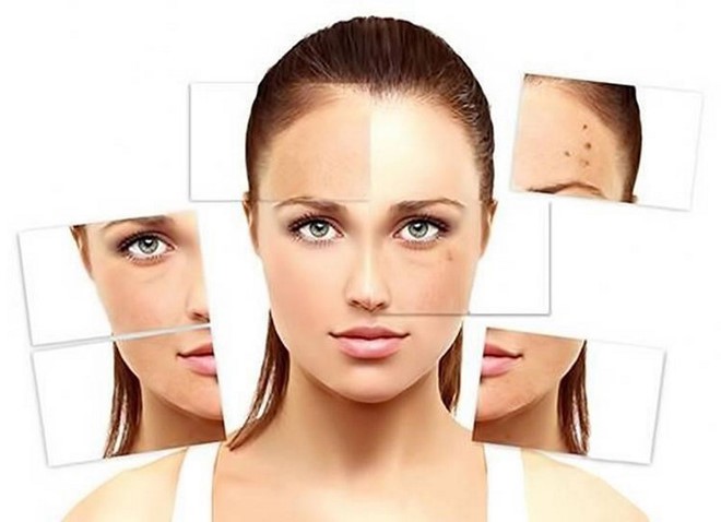 5 vấn đề làn da hay gặp phải trong mùa hè và cách khắc phục