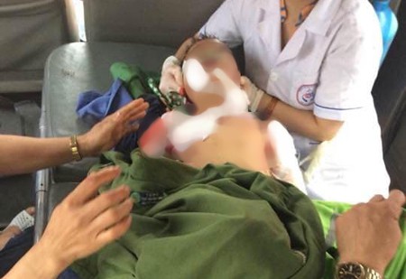 Lại thêm cháu bé 4 tuổi bị chó nhà cắn thương tâm