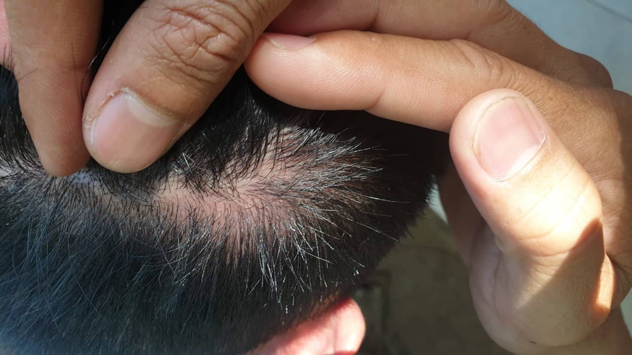 L&acirc;m Đồng: Ph&oacute;ng vi&ecirc;n bị c&ocirc;n đồ h&agrave;nh hung tại buổi mua hồ sơ dự thầu - Ảnh 3.