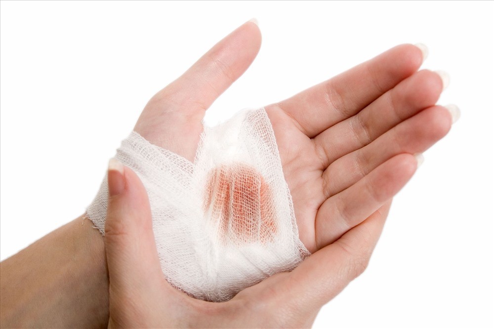 Mách nước 5 bước cần làm ngay khi bị chó cắn - Ảnh 4.