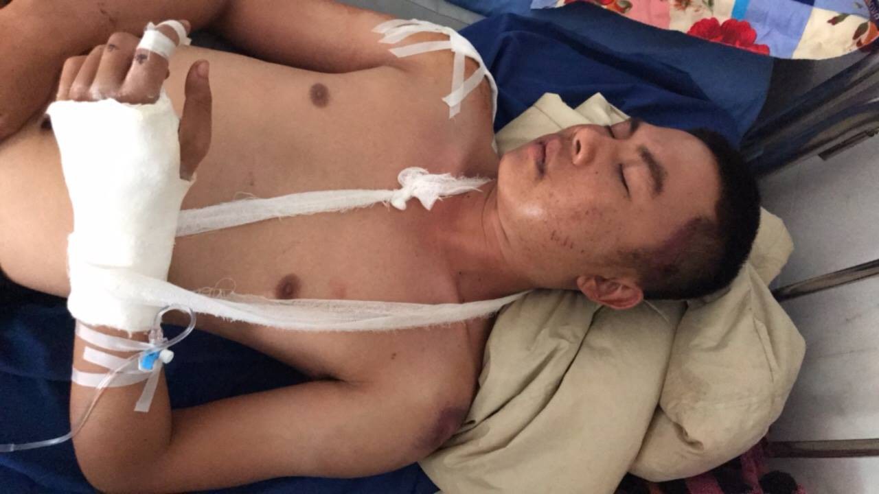 Đi đòi nợ, 1 người đàn ông bị đánh, chém bầm dập