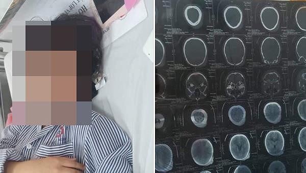 Vụ nữ sinh Quảng Ninh bị đánh hội đồng: Nạn nhân né tránh nói nguyên nhân sự việc - Ảnh 2.