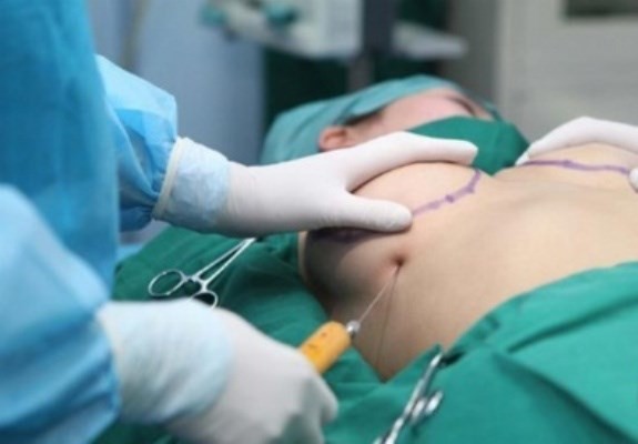 Sau n&acirc;ng cấp v&ograve;ng 1&rdquo; ở nước ngo&agrave;i, nữ doanh nh&acirc;n  trẻ nhập viện cấp cứu - Ảnh 1.
