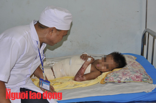 Vội vã đưa cháu bé bị phỏng đi chữa trị vì sợ gia đình ngăn cản