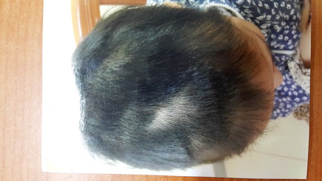 Người đàn bà U60 tật nguyền vẫn thuê côn đồ đánh ghen