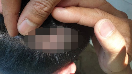 Thông tin sốc vụ 2 phóng viên bị hành hung tại Lâm Đồng
