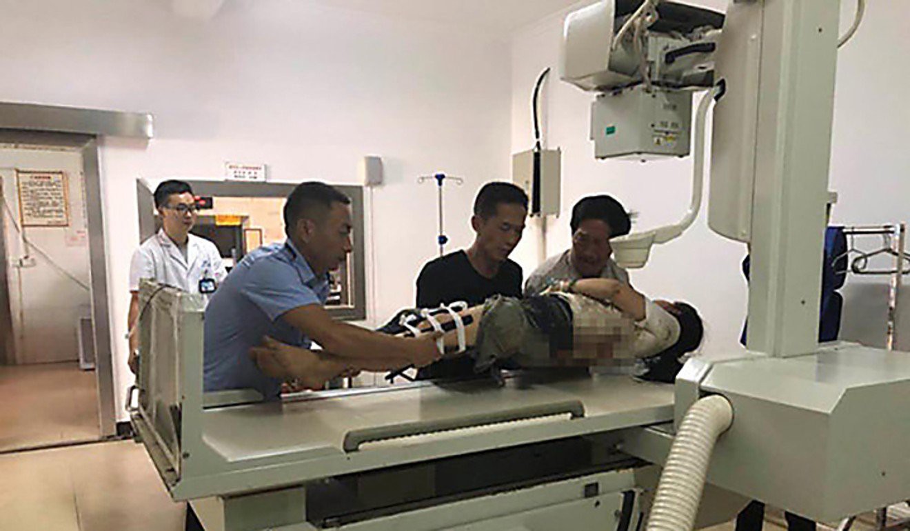 B&eacute; trai 9 tuổi bị ch&oacute; cắn chết ở Anh - Ảnh 2.