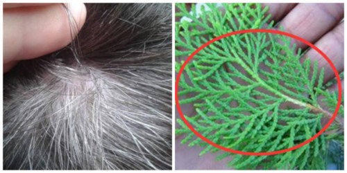 Tóc bạc 10 năm cũng nhanh chóng đen bóng trở lại