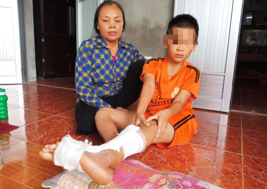 Học sinh lớp 5 đứt g&acirc;n ch&acirc;n trong giờ học, hiệu trưởng n&oacute;i chuyện c&oacute; g&igrave; lớn m&agrave; l&agrave;m ầm l&ecirc;n - Ảnh 2.