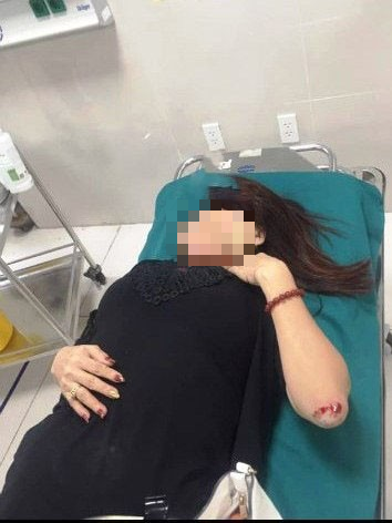 Vợ chồng nữ doanh nh&acirc;n ở Quảng B&igrave;nh tố bị x&atilde; hội đen d&ugrave;ng s&uacute;ng truy s&aacute;t - Ảnh 1.