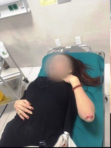 Tìm thấy 4 viên đạn ở nhà nữ doanh nhân tố bị "xã hội đen" truy sát