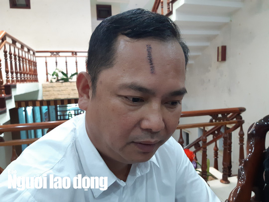 Vụ giang hồ vây xe công an ở Đồng Nai: Ông Lê Vũ Trường Hải lên tiếng