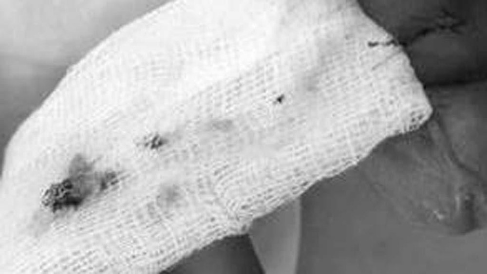 Nam thanh ni&ecirc;n bị liệt dương sau khi chữa yếu sinh l&yacute; - Ảnh 2.
