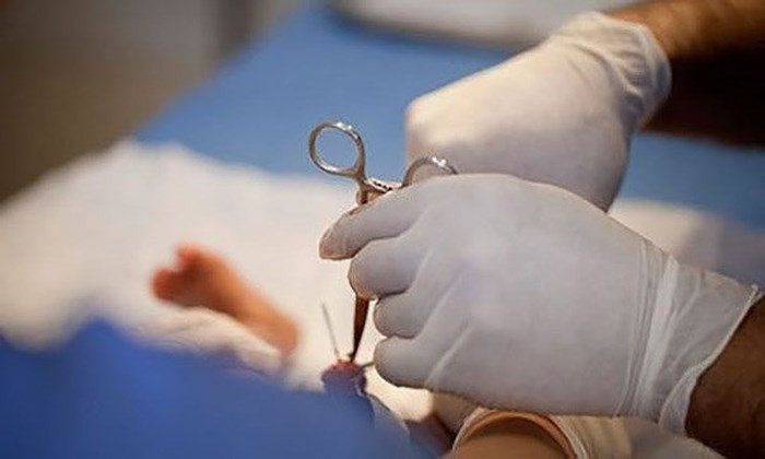 Nam thanh ni&ecirc;n bị liệt dương sau khi chữa yếu sinh l&yacute; - Ảnh 1.