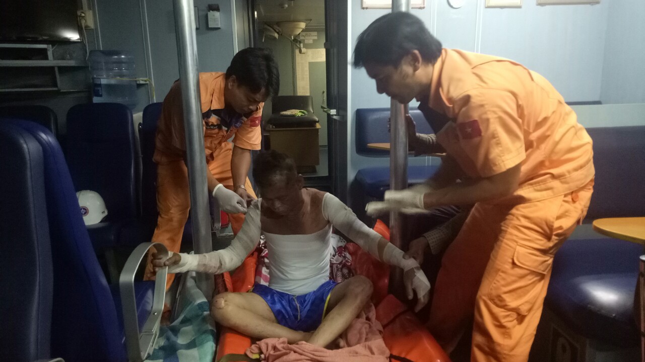 Ch&aacute;y hầm m&aacute;y, một ngư d&acirc;n bị bỏng nặng - Ảnh 1.