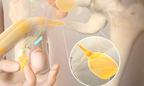 Dùng "công tắc" điều khiển "cậu nhỏ" theo ý muốn