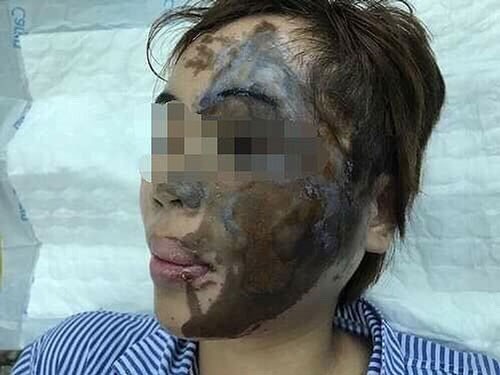 Lần đầu tiên tạo hình "tươi" cho cô gái bị tạt axít