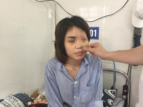 Lần đầu tiên tạo hình tươi cho cô gái bị tạt axít - Ảnh 2.