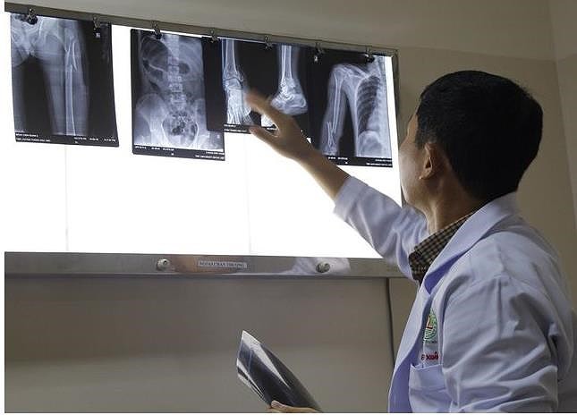 Thanh niên nhảy từ lầu 4 xuống đất vì bị cản... lấy chồng!