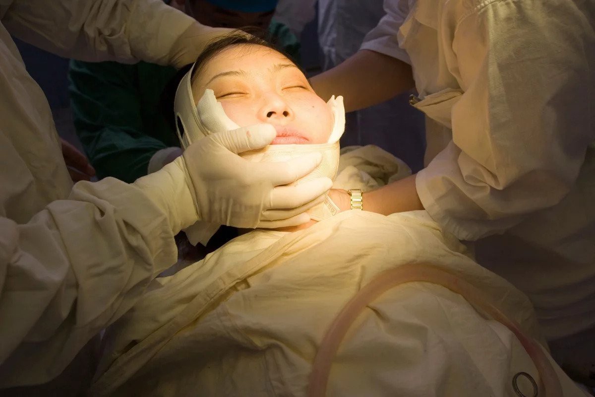 Giới trẻ Trung Quốc đua nhau nhờ "dao kéo" để cải thiện nhan sắc